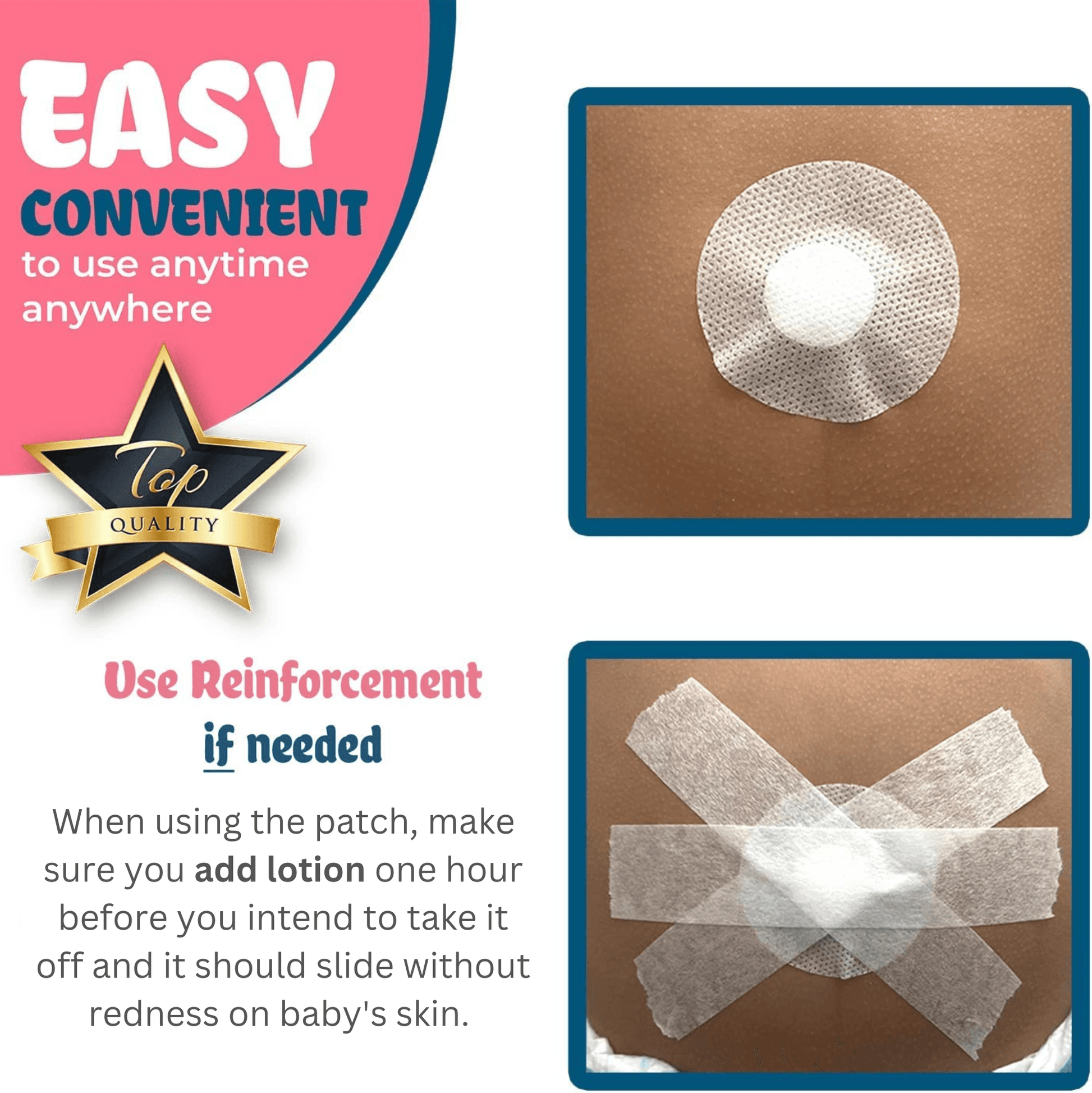 Baby Belly Button Shaper - Plug - Baby Belly Button Shaper