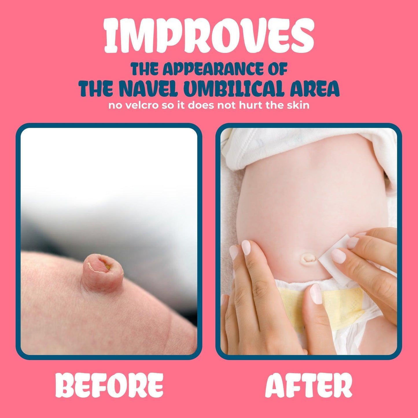 Baby Belly Button Shaper Plug and Tape - Baby Belly Button Shaper