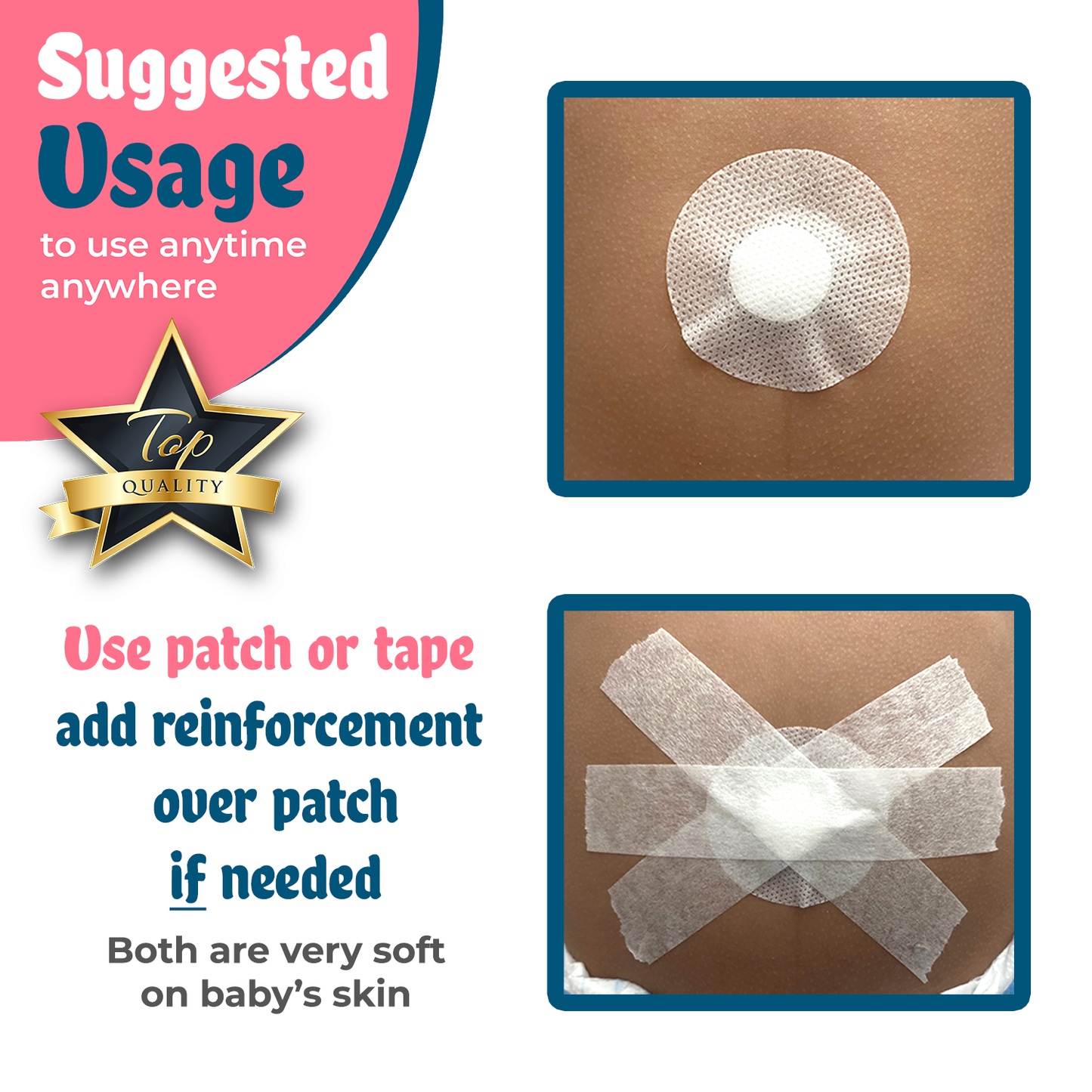 Baby Belly Button Shaper Plug and Patch